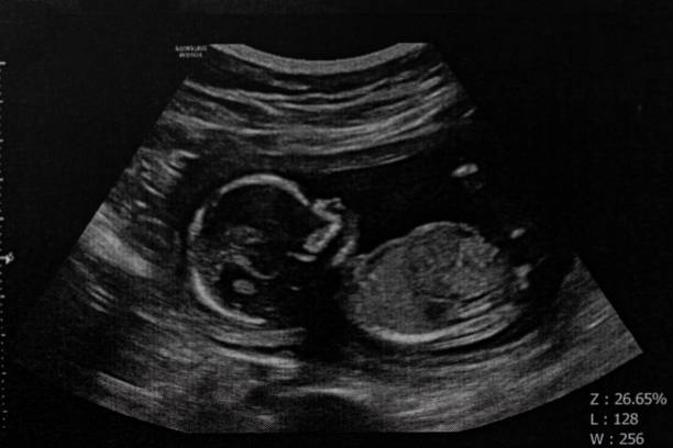 A fake ultrasound could make you succeed in the planned prank post thumbnail image